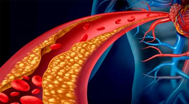 Dislipidemia